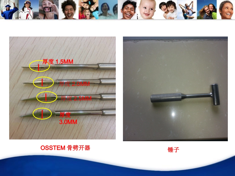 骨劈开手术_第5页