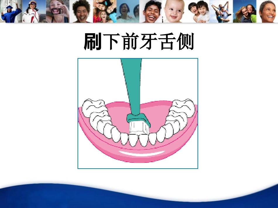 洁牙宣教资料PPT_第13页
