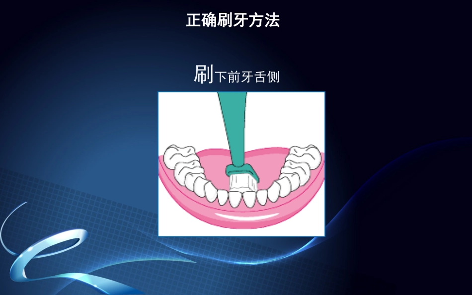 种植牙围手术期及术后口腔保健_第10页