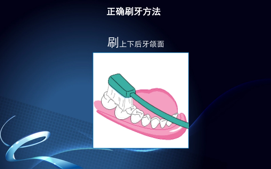 种植牙围手术期及术后口腔保健_第12页