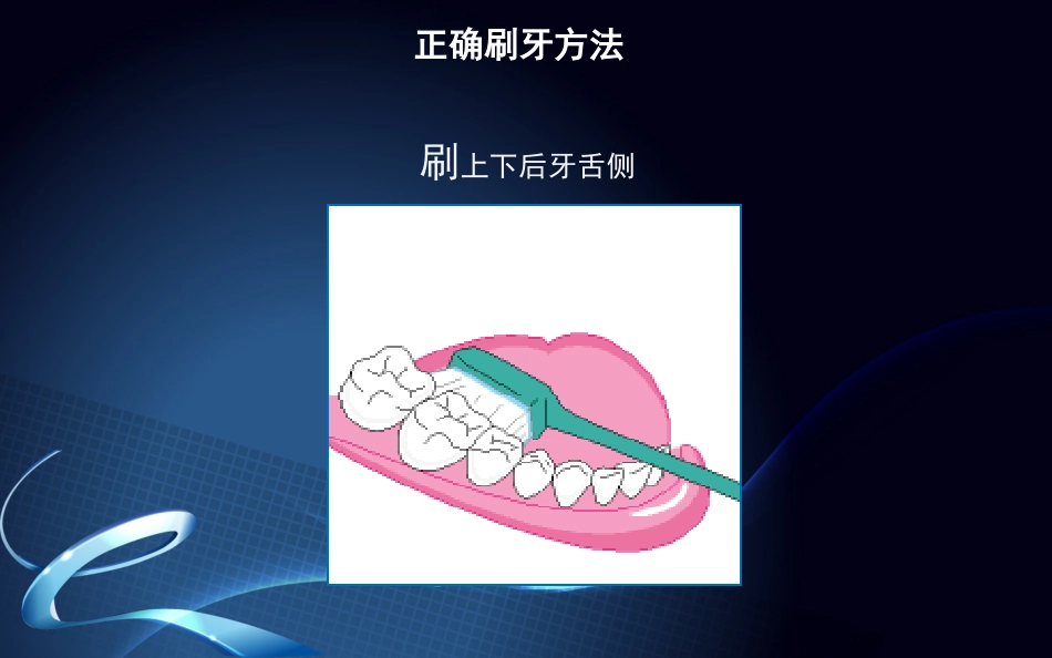 种植牙围手术期及术后口腔保健_第13页