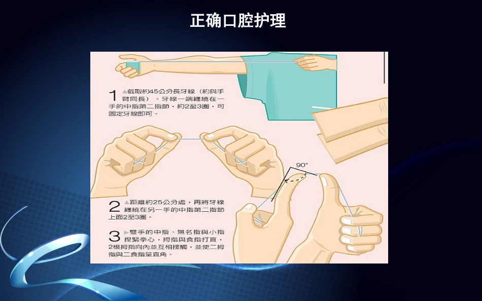 种植牙围手术期及术后口腔保健_第14页