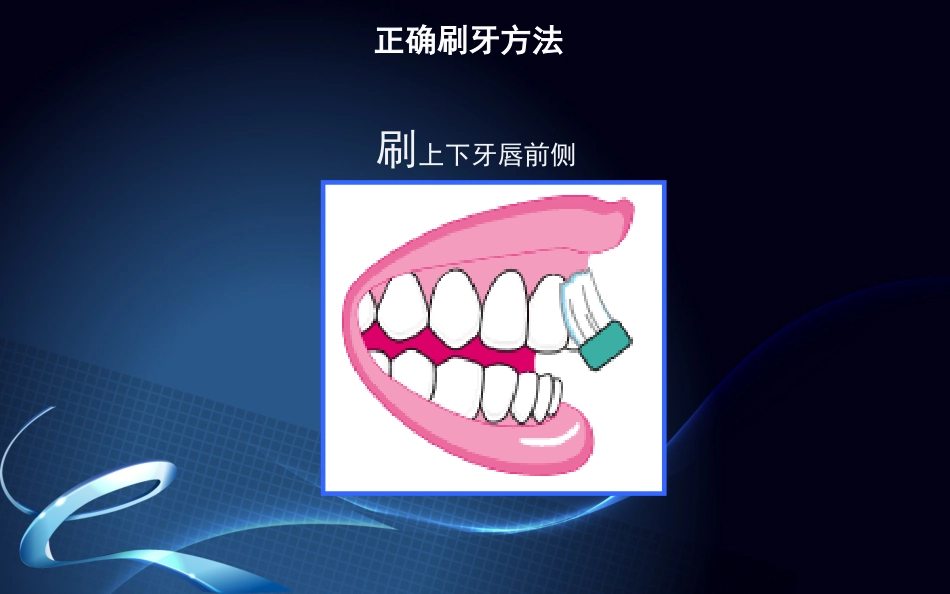 种植牙围手术期及术后口腔保健_第9页