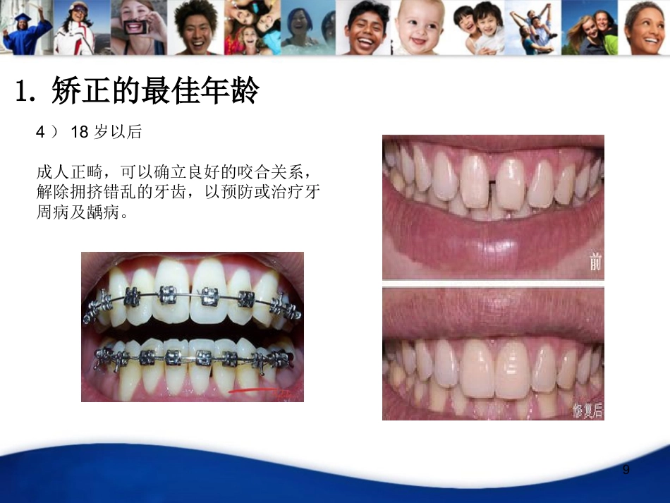 中青年口腔知识宣教资料PPT_第9页