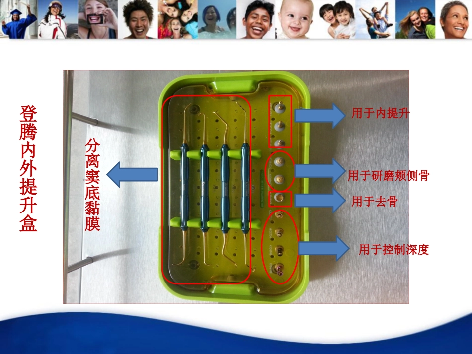 上颌窦外提升手术_第15页