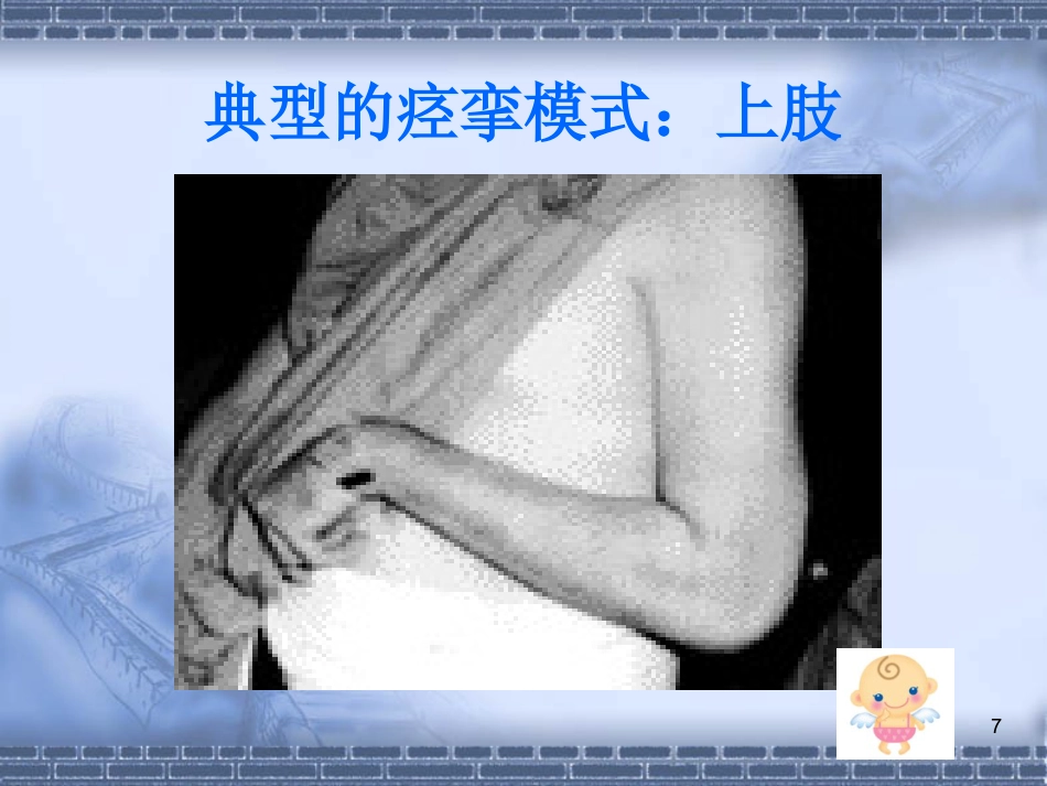 脑神经-脑卒中的康复治疗(健康教育)_第7页