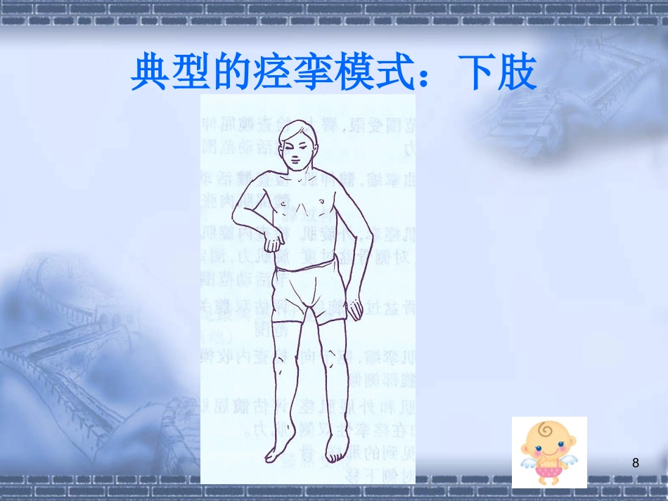 脑神经-脑卒中的康复治疗(健康教育)_第8页