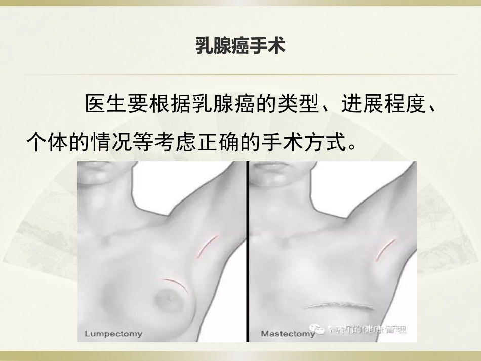 话说乳腺癌_第13页