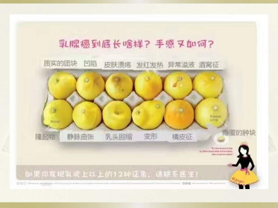 话说乳腺癌_第4页