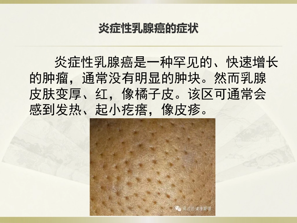 话说乳腺癌_第5页
