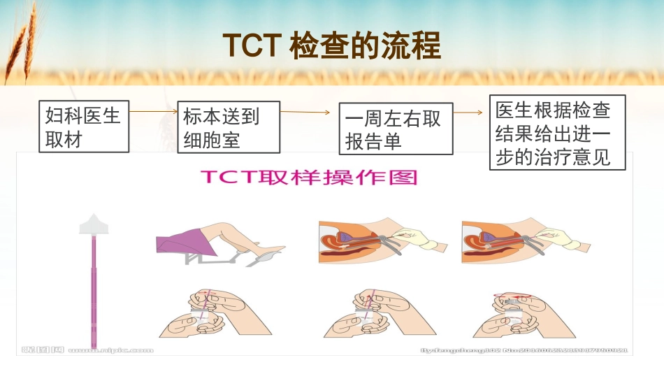 宫颈癌的预防_第13页