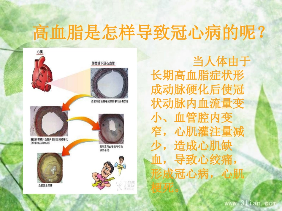 血脂异常 可防可控_第15页