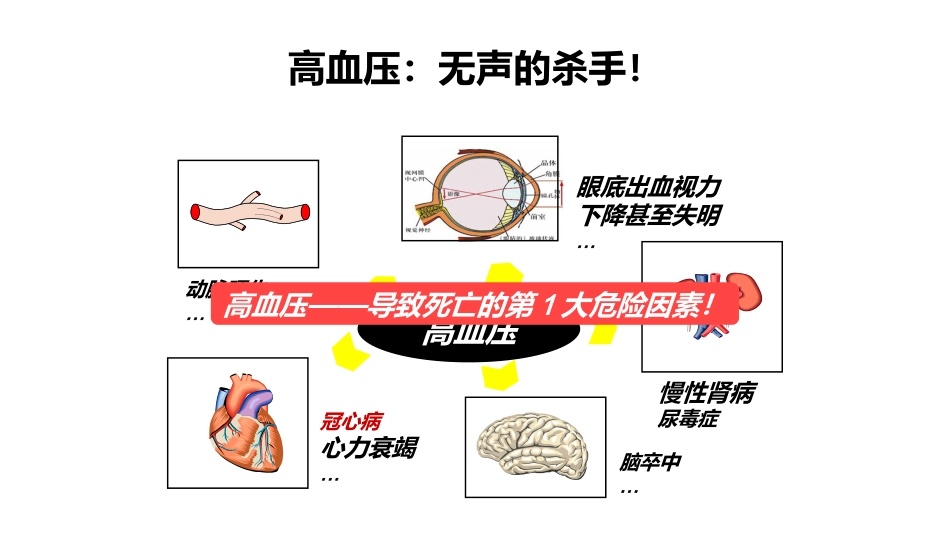 高血压科普宣教_第8页