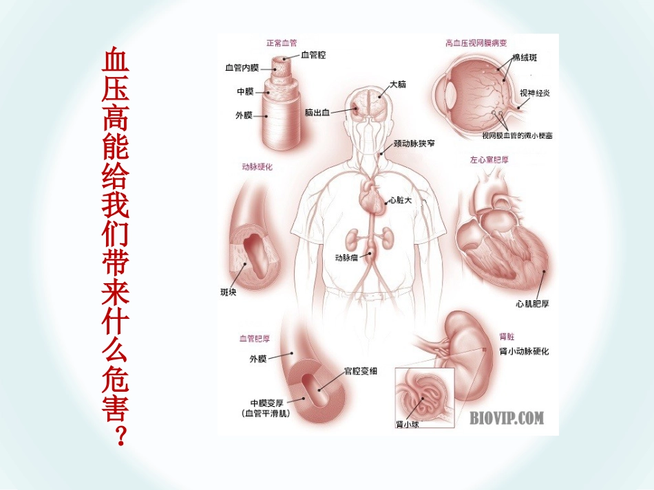 继发性高血压_第13页