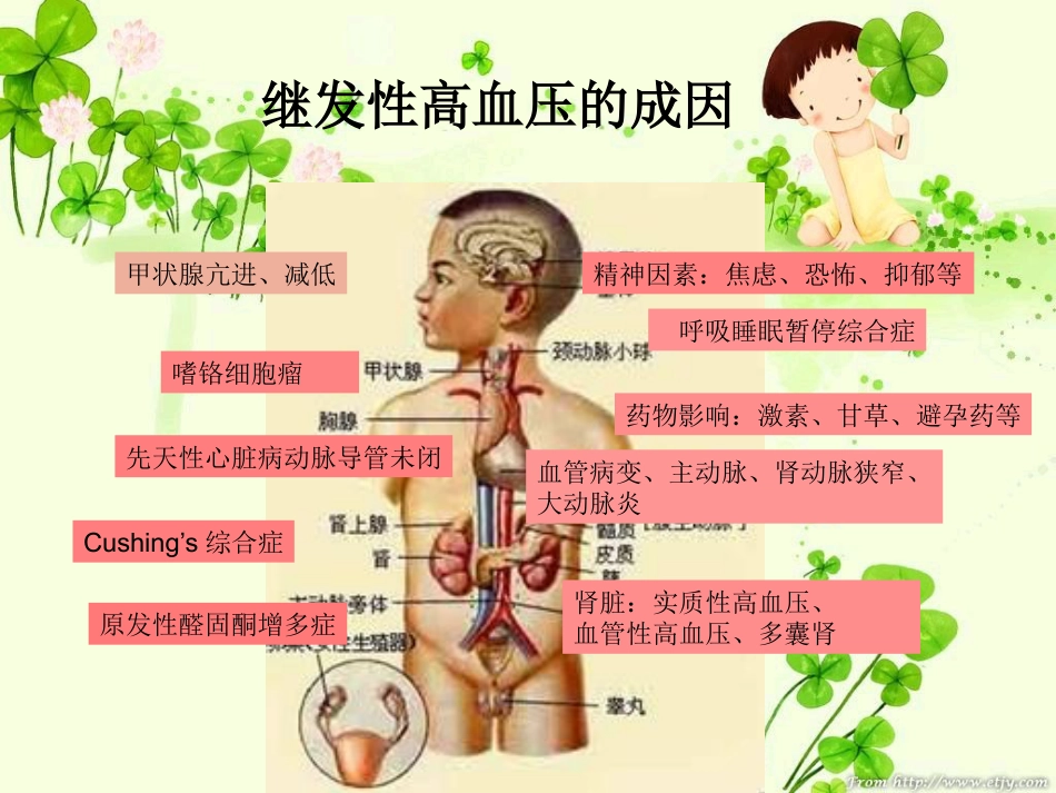 继发性高血压_第8页