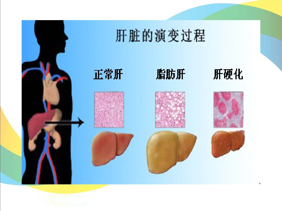 关爱健康，保护肝脏_第14页