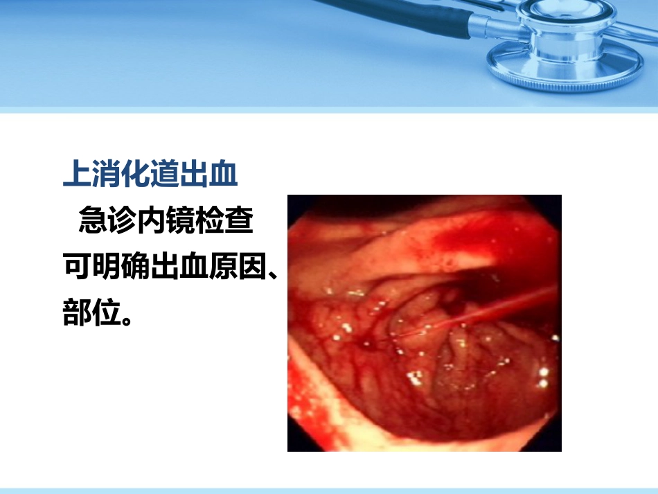 消化性溃疡_第12页