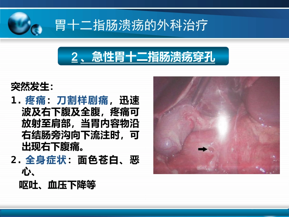 胃十二指肠疾病_第12页