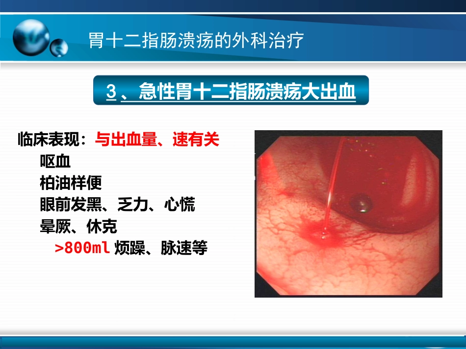 胃十二指肠疾病_第14页