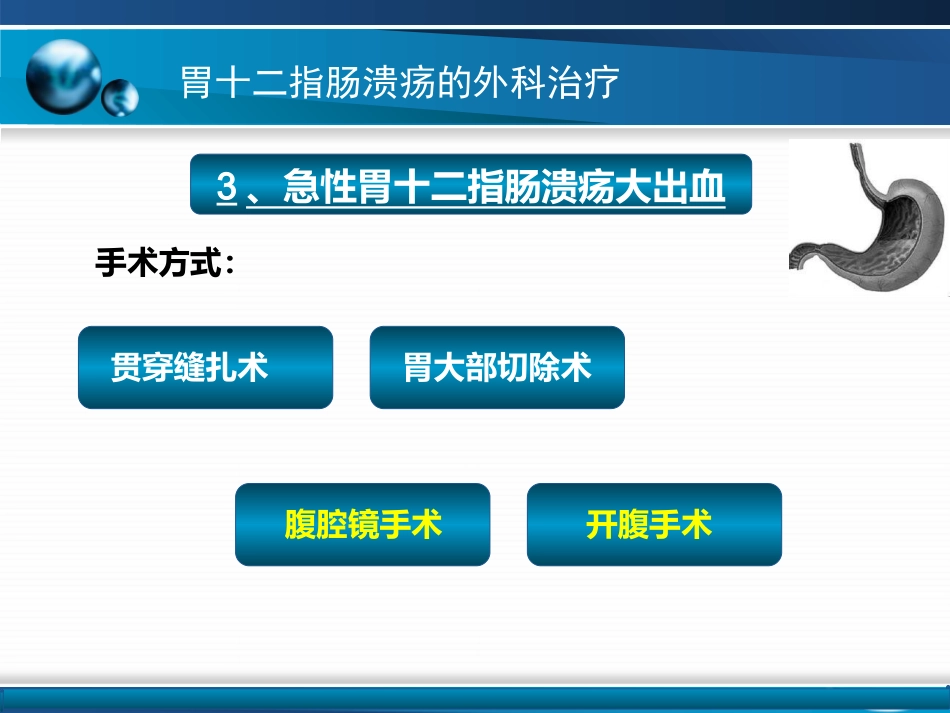 胃十二指肠疾病_第15页