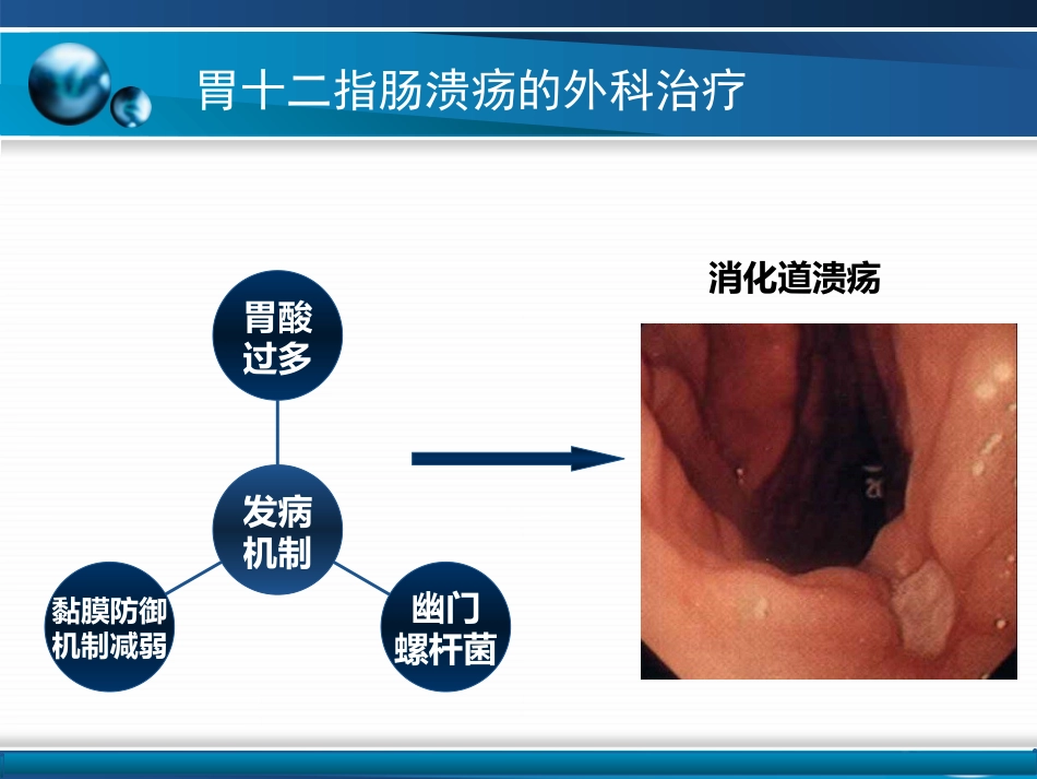胃十二指肠疾病_第9页