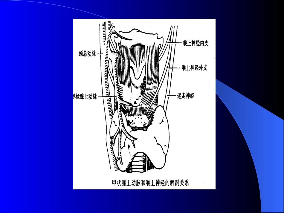 内分泌科-甲状腺和乳腺疾病的外科治疗_第3页