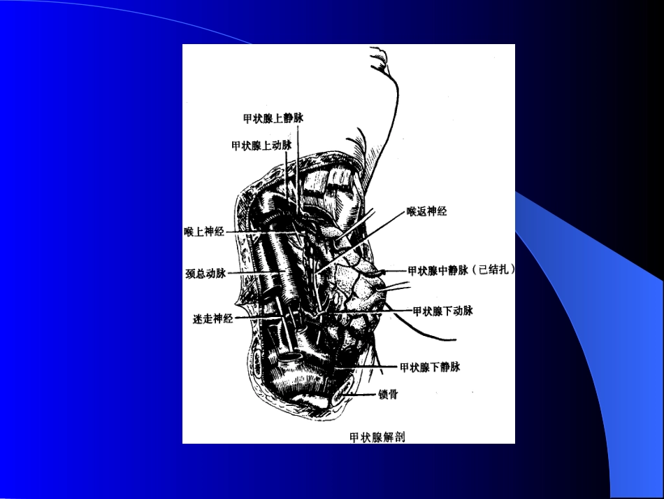 内分泌科-甲状腺和乳腺疾病的外科治疗_第4页