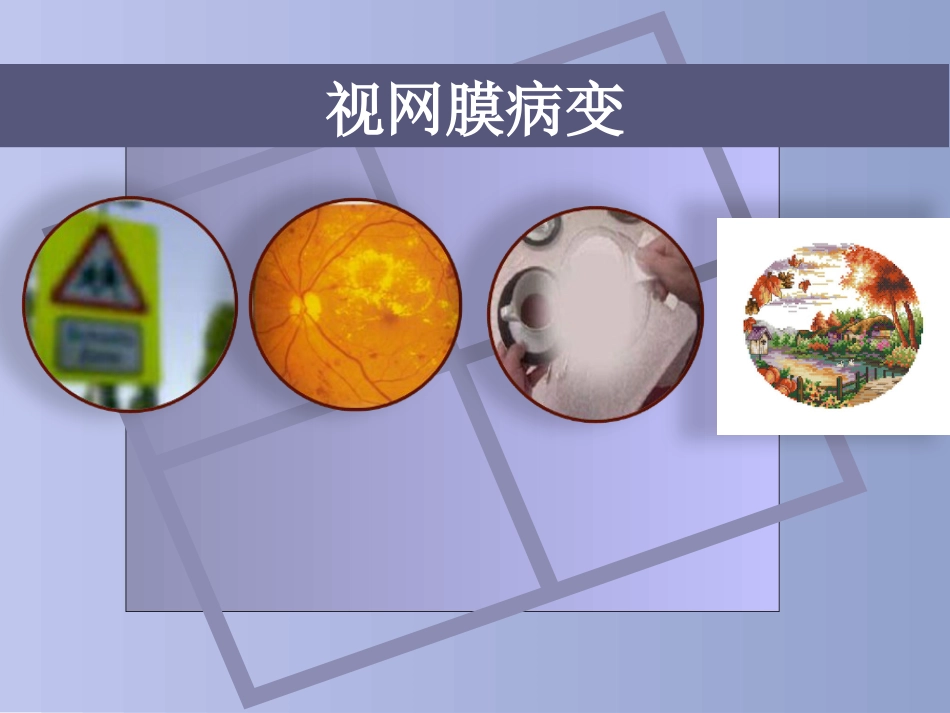 糖尿病慢性并发症及防治_第11页