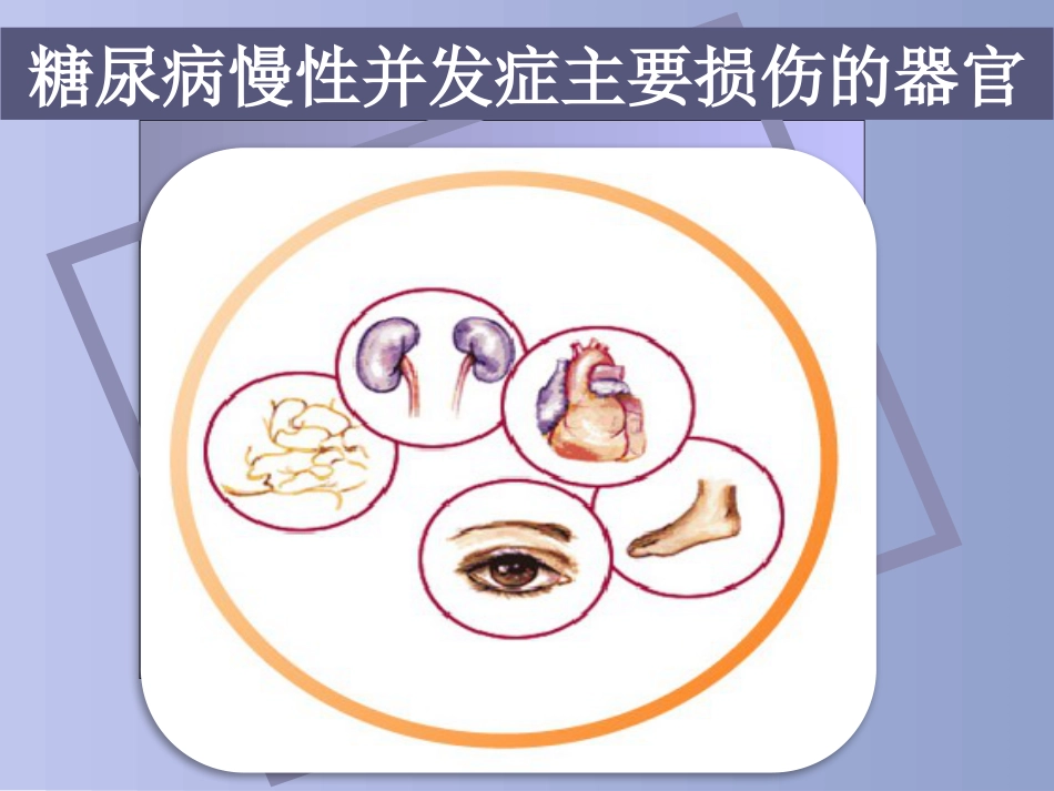 糖尿病慢性并发症及防治_第3页