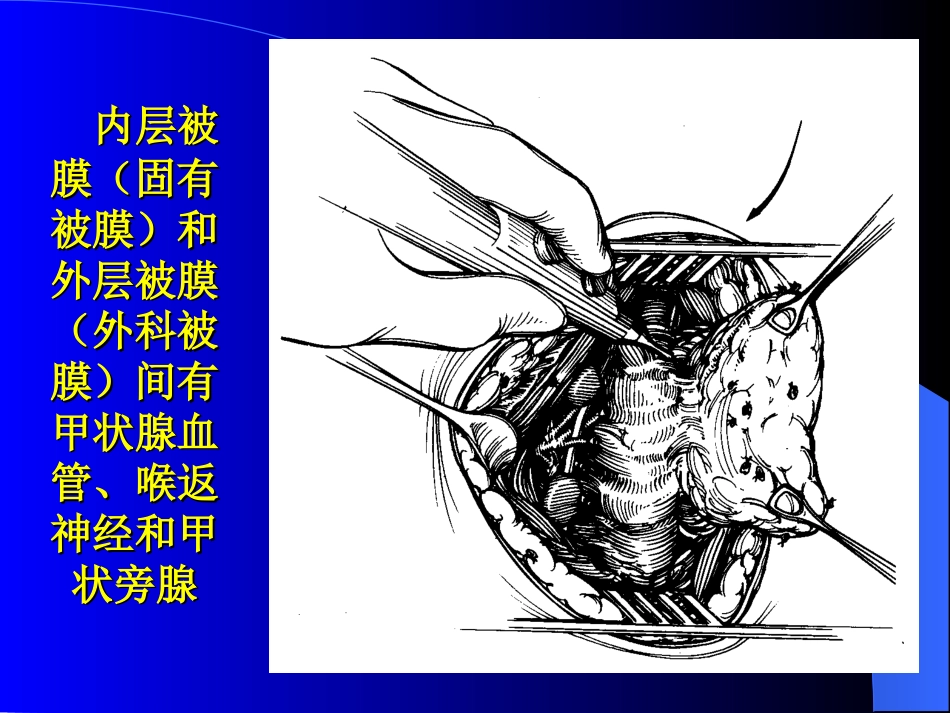 内分泌科-甲状腺疾病教学教案_第10页