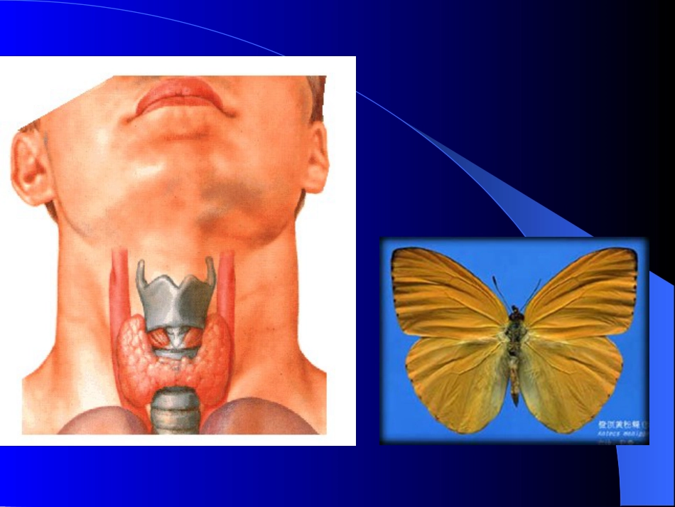 内分泌科-甲状腺疾病教学教案_第8页