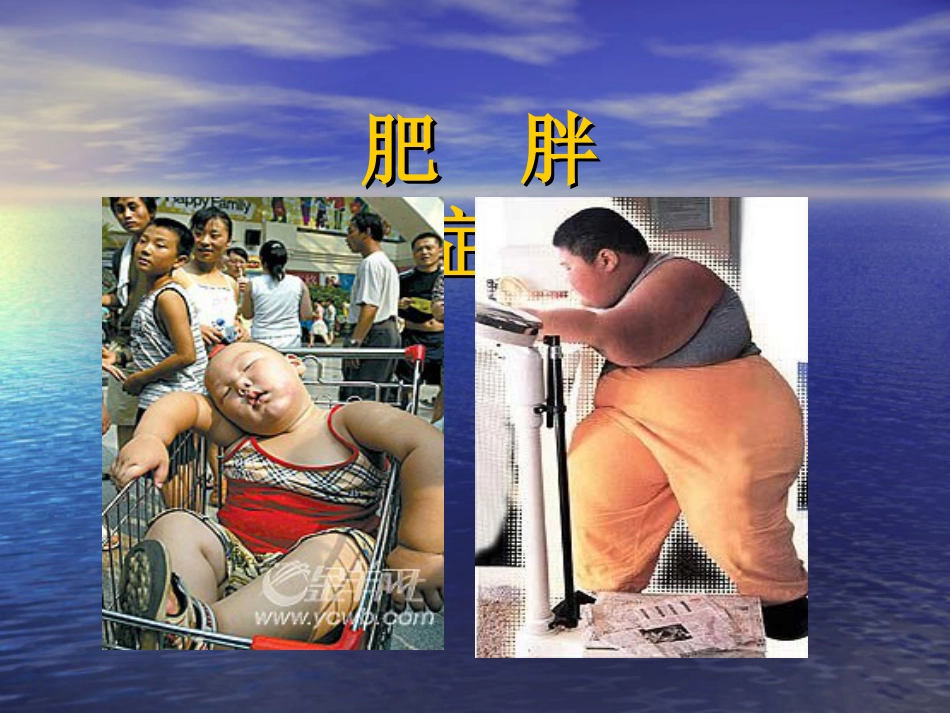 内分泌科-肥胖症及其预防PPT讲解_第1页