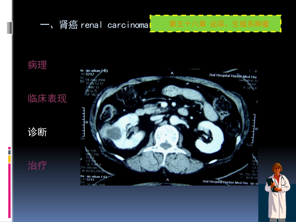 泌尿科-泌尿系肿瘤_第10页