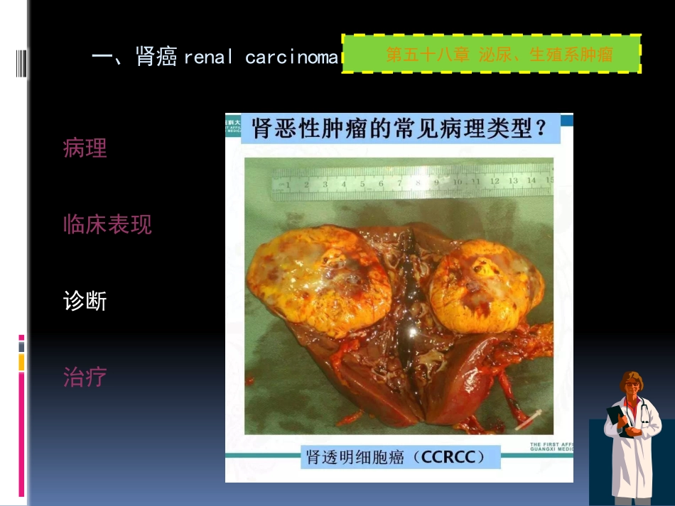 泌尿科-泌尿系肿瘤_第13页