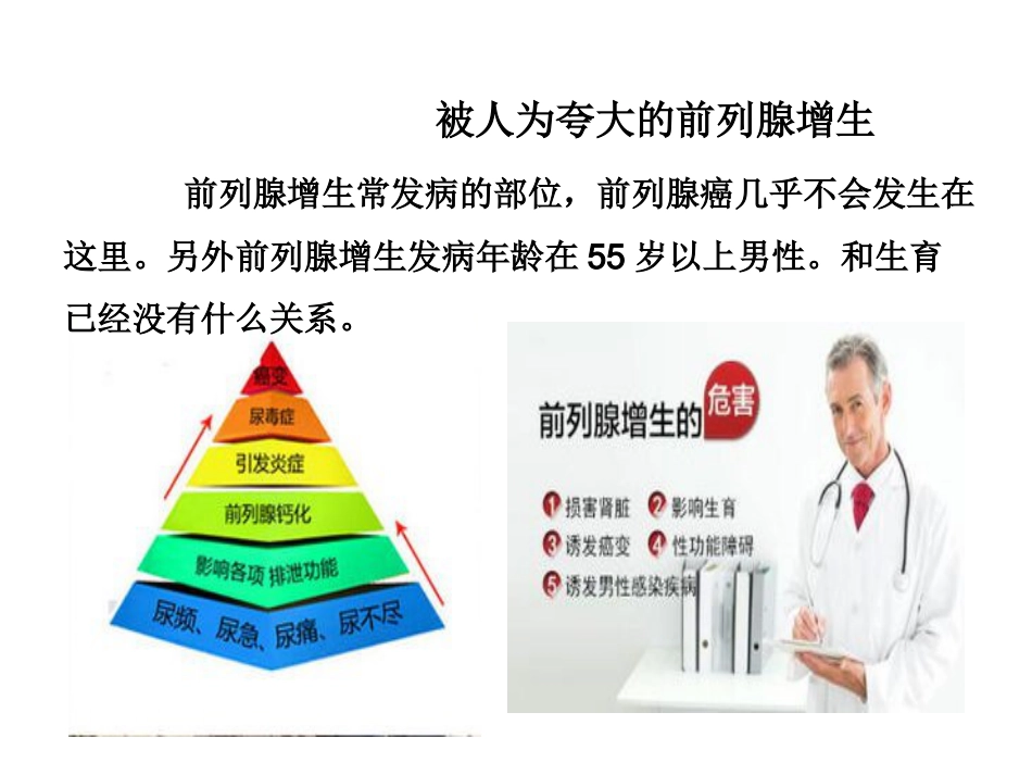 前列腺增生_第4页