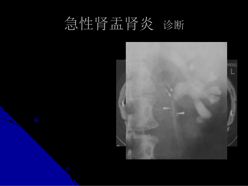 泌尿科-泌尿、男性生殖系统感染_第13页