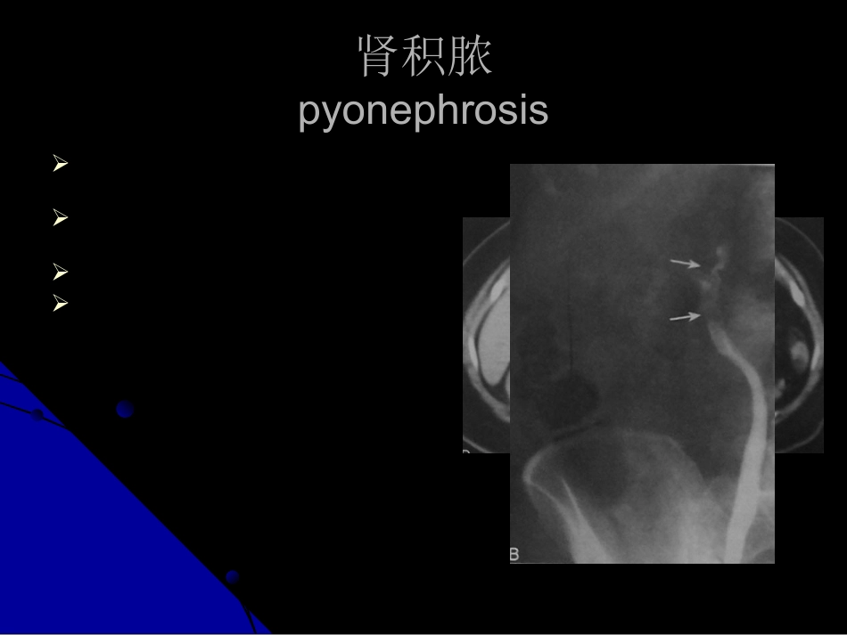 泌尿科-泌尿、男性生殖系统感染_第15页