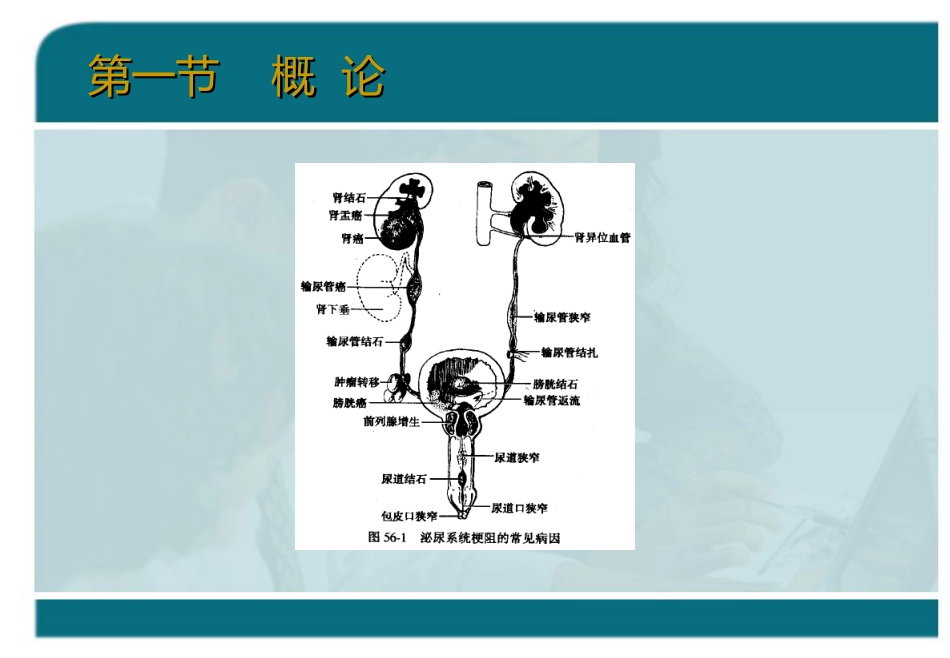 泌尿科-泌尿系统梗阻_第6页