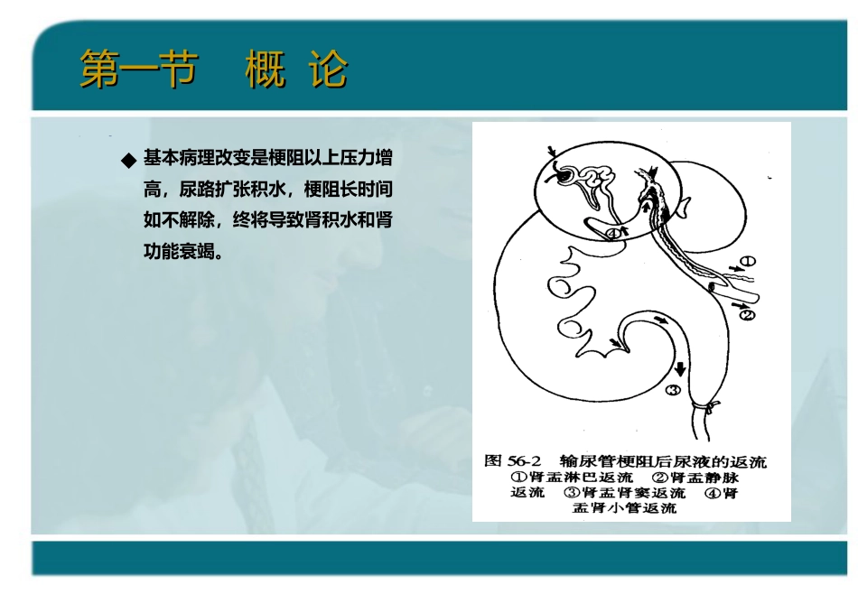 泌尿科-泌尿系统梗阻_第7页
