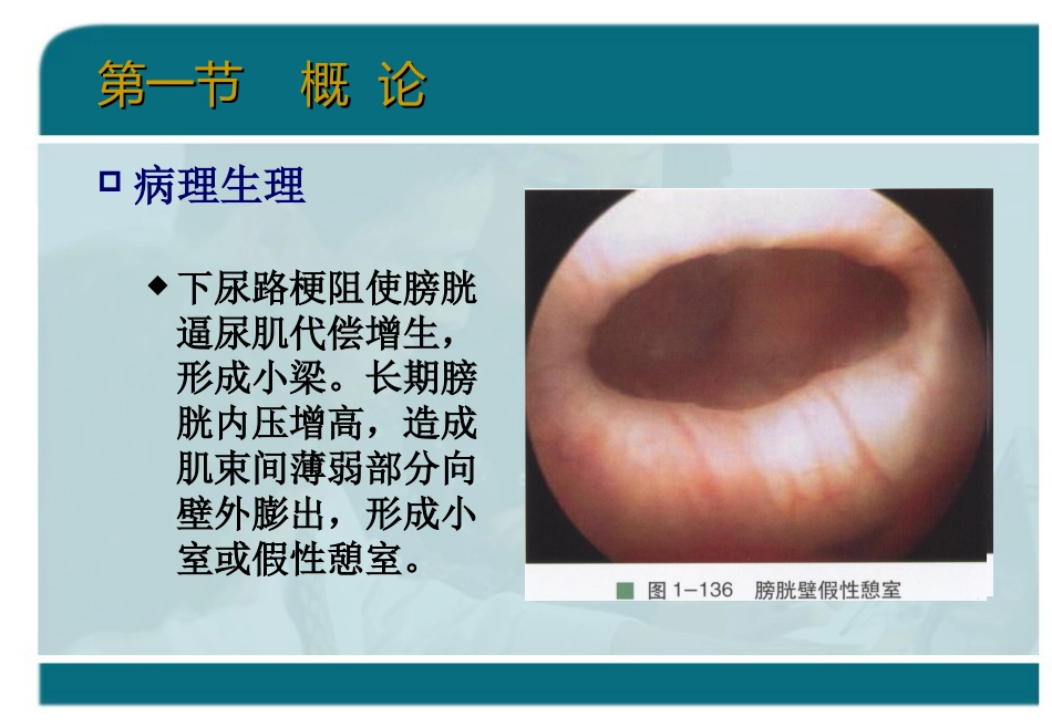 泌尿科-泌尿系统梗阻_第8页