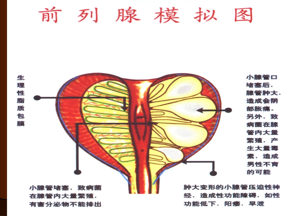 男科-慢性前列腺_第12页