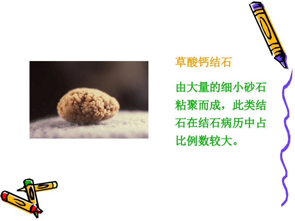 泌尿科-泌尿系结石病人的护理_第6页