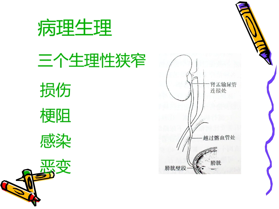 泌尿科-泌尿系结石病人的护理_第9页
