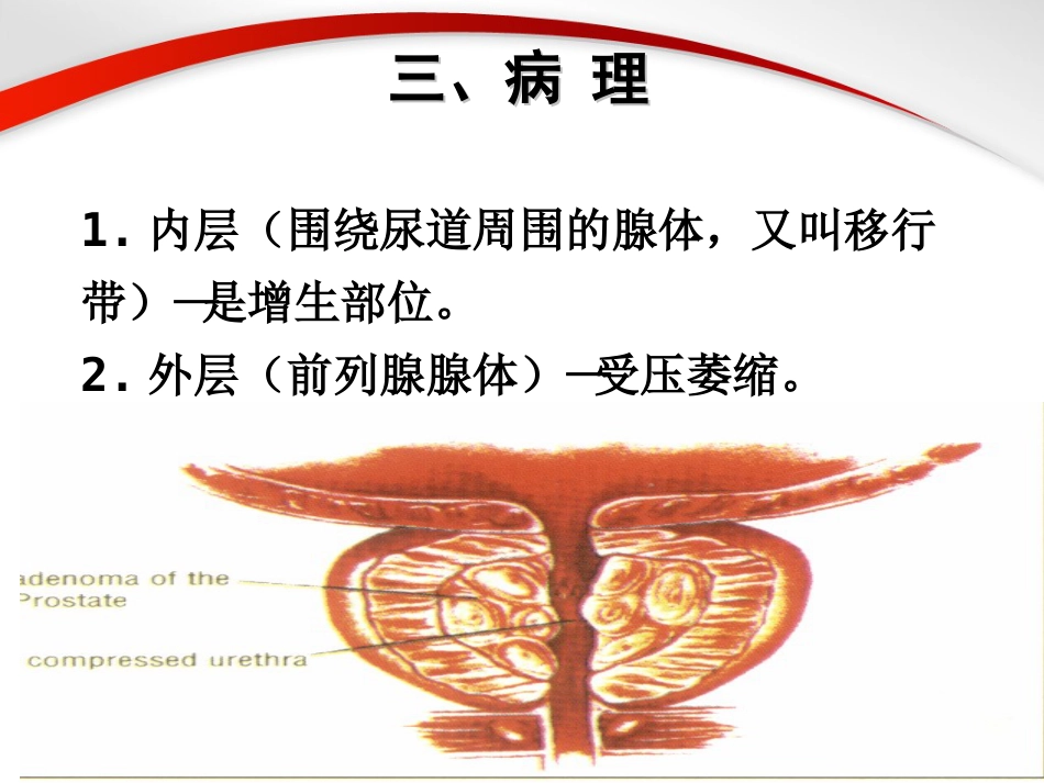男科-前列腺_第14页
