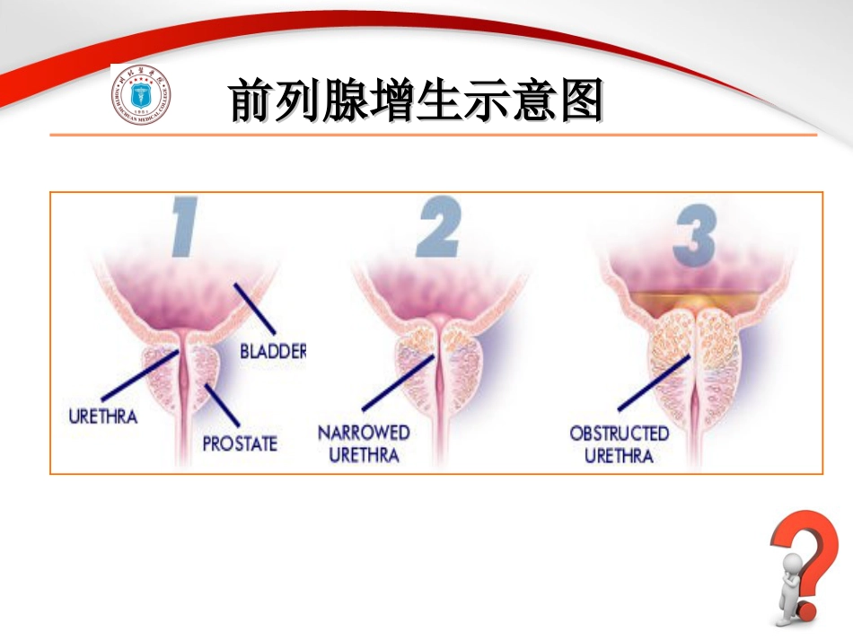 男科-前列腺_第15页