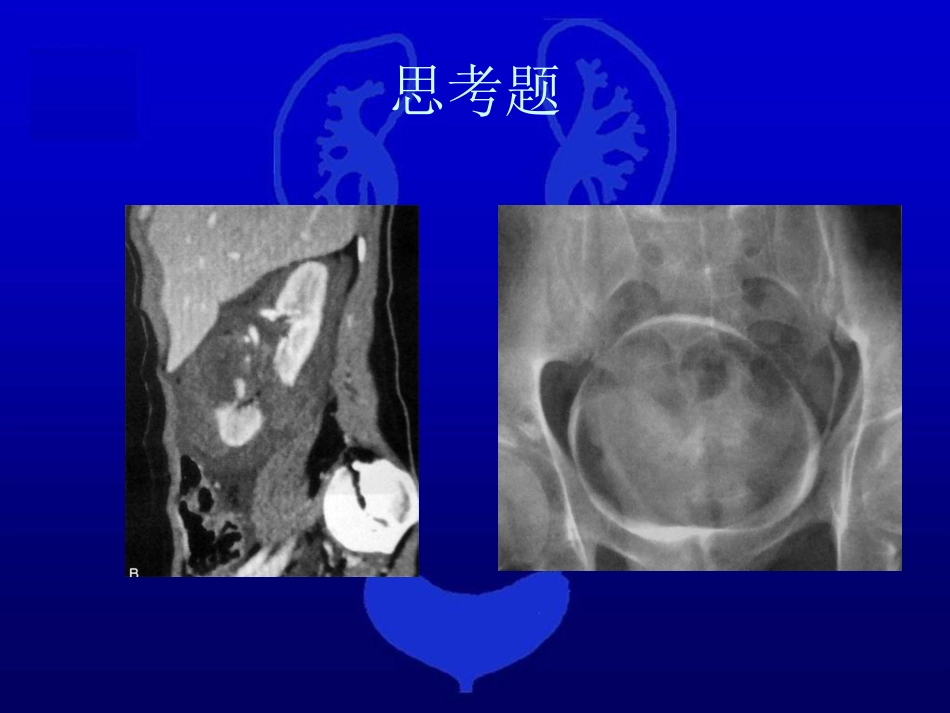 泌尿科-泌尿系统损伤2_第14页