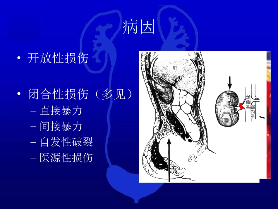 泌尿科-泌尿系统损伤2_第5页