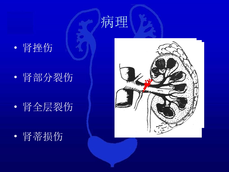 泌尿科-泌尿系统损伤2_第6页
