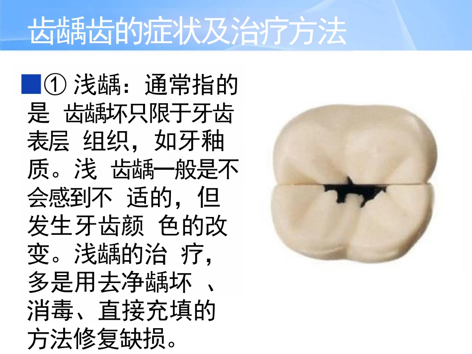 中老年人常见口腔问题_第12页
