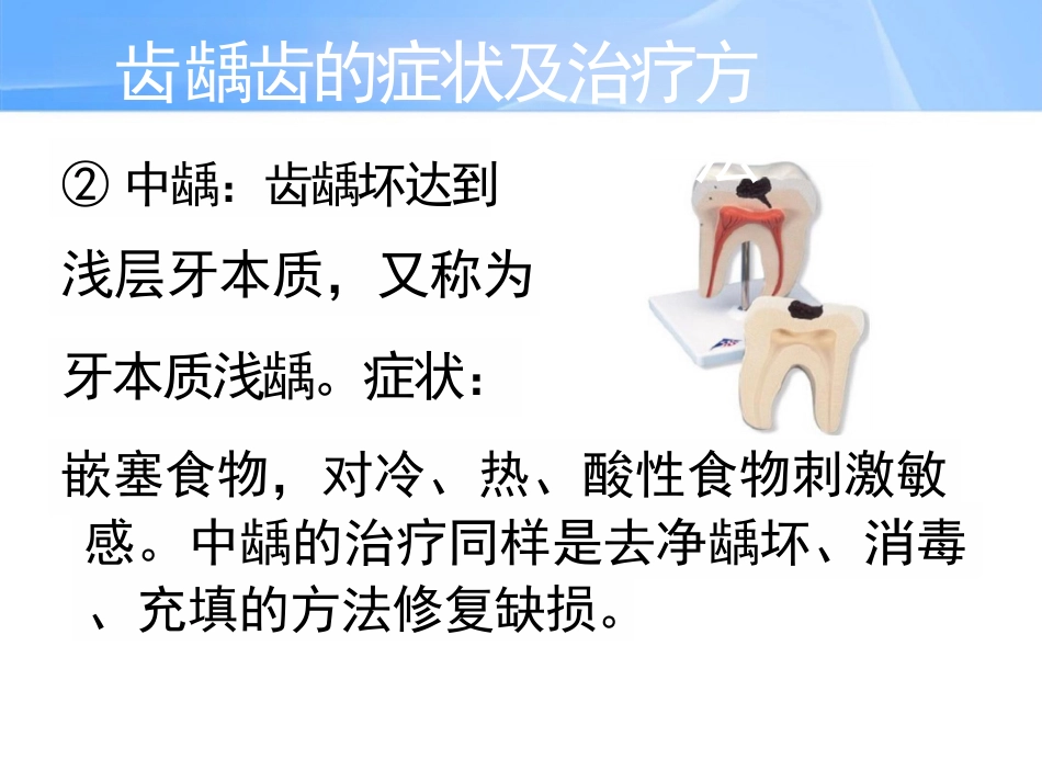 中老年人常见口腔问题_第13页